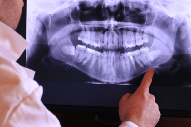 Best Cracked Tooth Emergency Dentist  in Oxford, MI