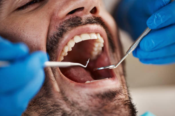 Best Dentist for Tooth Abscess  in Oxford, MI